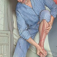 Diabetic-foot-treatment